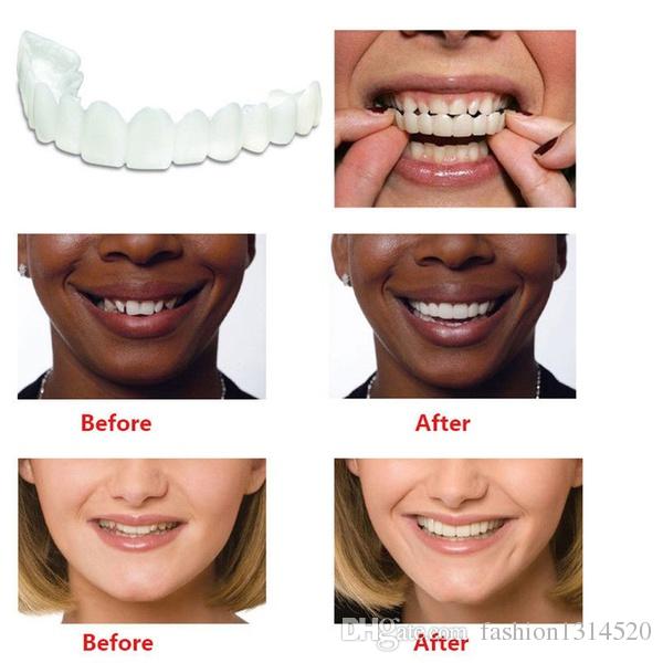 Instant Comfort Fit Cosmetic Whitening Teeth Denture Teeth Cover Top Cosmetic
