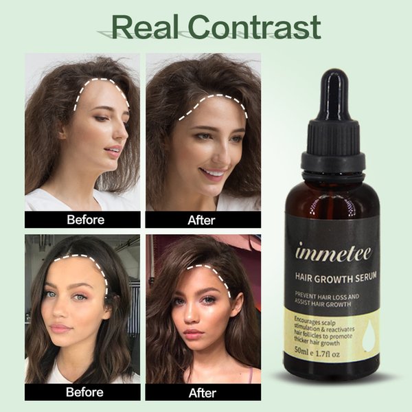 Powerful Hair Growth Serum Prevent Hair Loss Essential Oil Longer Thicker Prevent Baldness Products Hair Grow Growth 3pcsSc